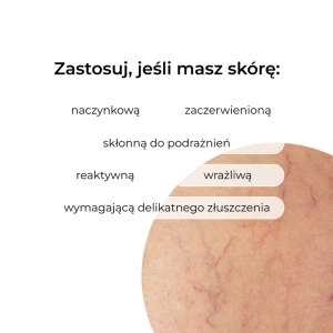 Veoli Botanica Redness Rescue Peel kojąco-wygładzający peeling na naczynka 30 ml