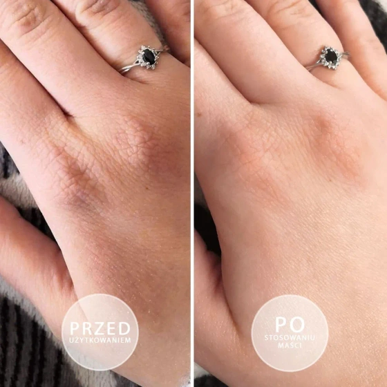 Beautica S.O.S. intensywnie natłuszczająca maść do dłoni i stóp z witaminą E 15 ml